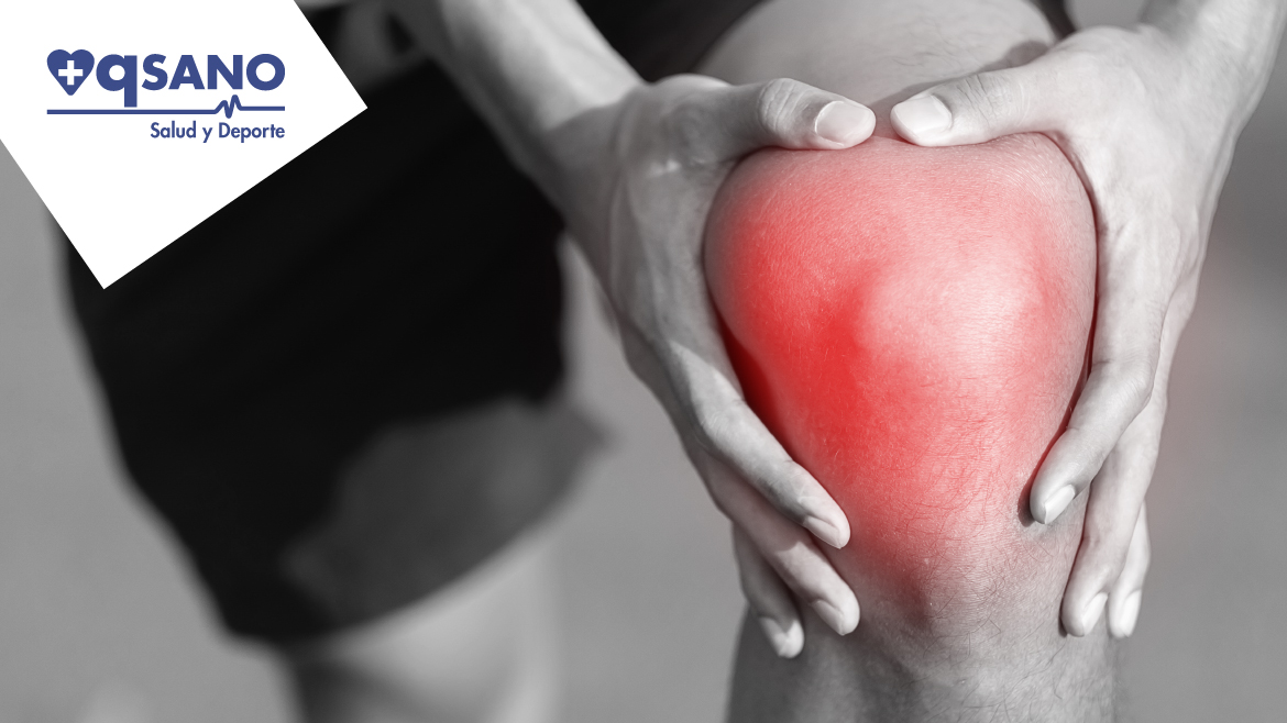 Esguince de rodilla: qué es y cómo tratarlo